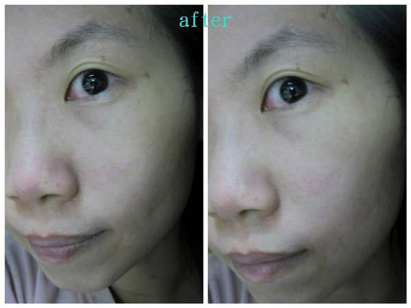 勻朵Young靚妍瞬效保濕面膜