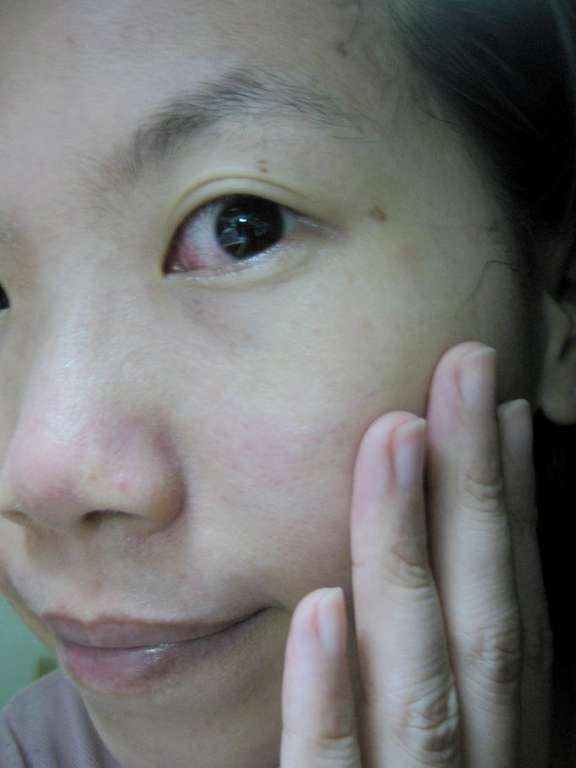 勻朵Young靚妍瞬效保濕面膜