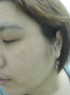 勻朵Young靚妍瞬效保濕面膜