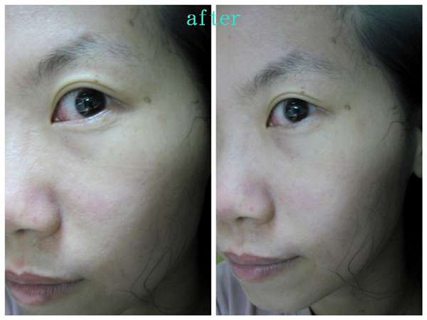 勻朵Young靚妍瞬效保濕面膜