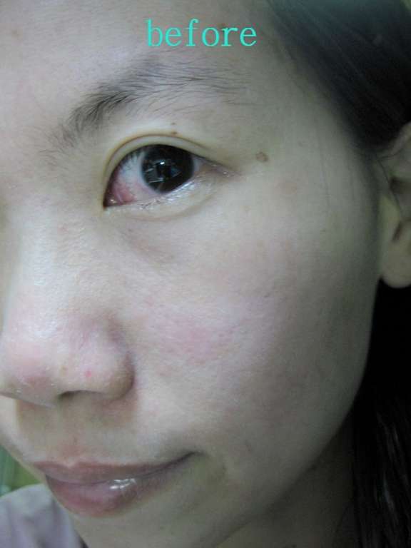 勻朵Young靚妍瞬效保濕面膜