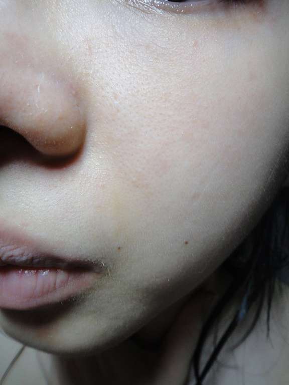 女人知己 試用 大隊 勻朵 Young 靚妍瞬效保濕 面膜 YouDo chialo