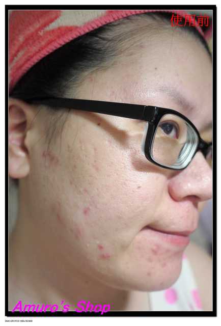 芯漫100%真蠶絲草本保濕舒緩面膜