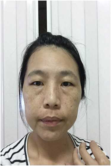 芯漫100%真蠶絲草本保濕舒緩面膜