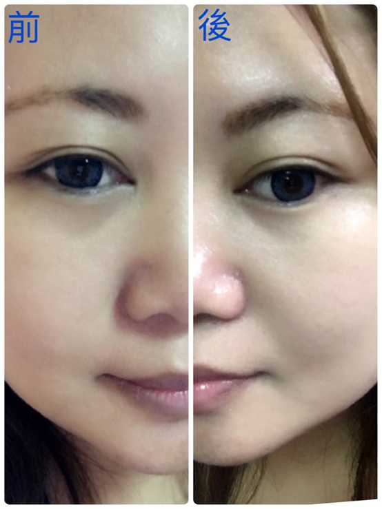 芯漫100%真蠶絲草本保濕舒緩面膜