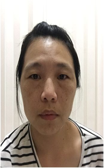 芯漫100%真蠶絲草本保濕舒緩面膜