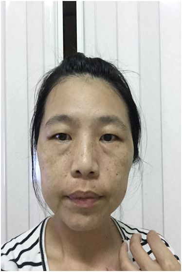 芯漫100%真蠶絲草本保濕舒緩面膜