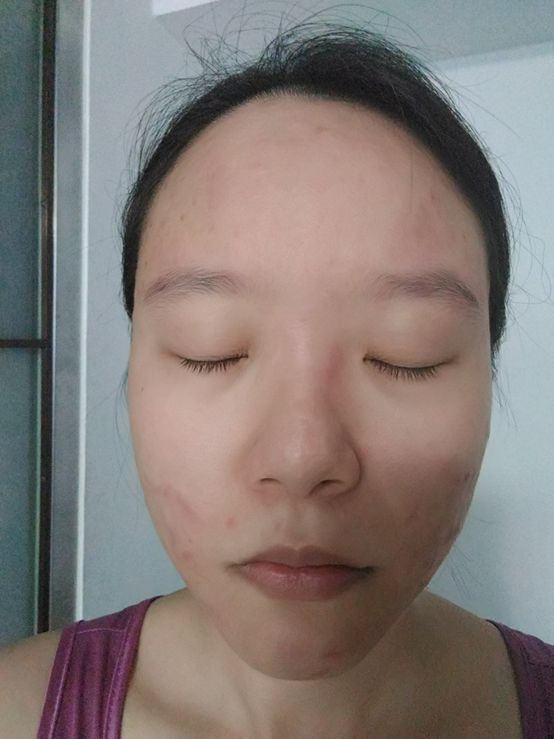 芯漫100%真蠶絲草本保濕舒緩面膜