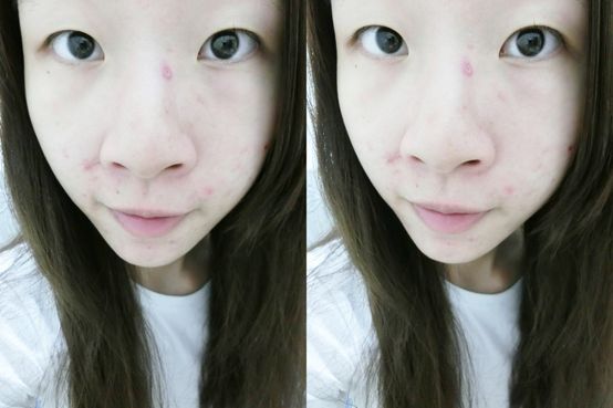 芯漫100%真蠶絲草本保濕舒緩面膜