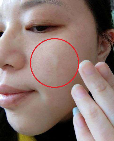 Q阿寶純質精華液4