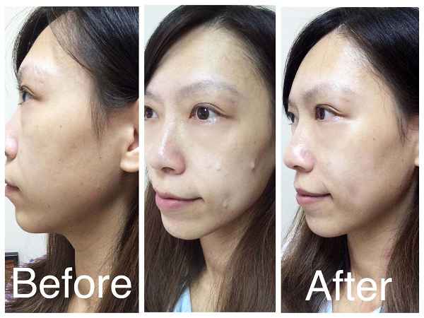 SUIKAN HADA水感肌精華安瓶水光劑