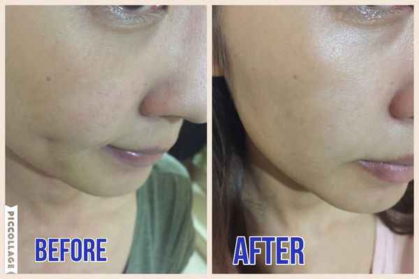 EMIS海泉水仙系列精華液