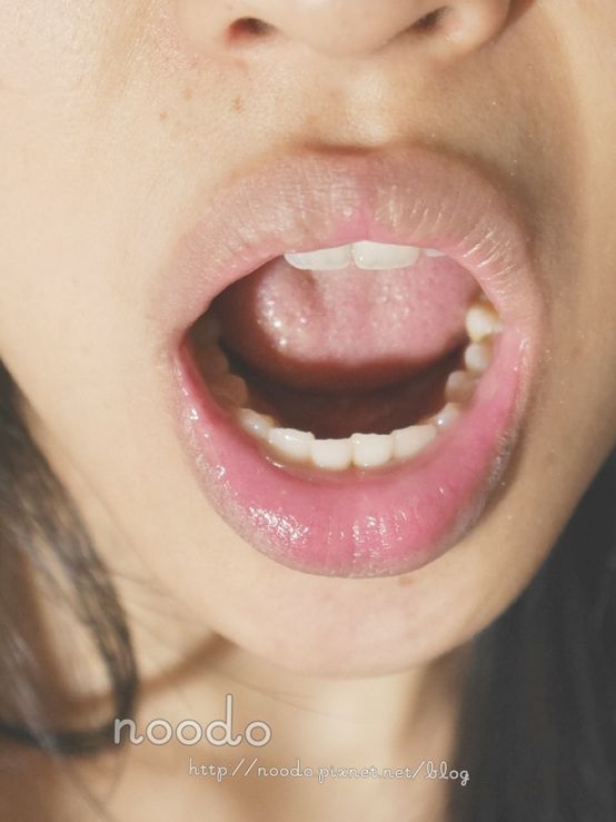 Dr.CurveS113專利乳酸菌