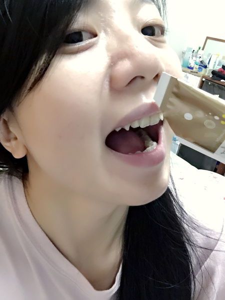 Dr.CurveS113專利乳酸菌