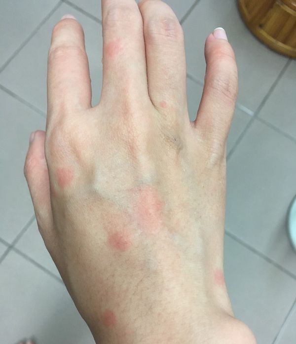 NATURKEY力萃奇防蚊液