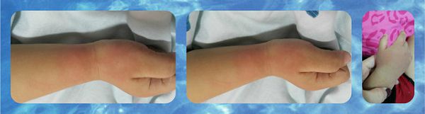 NATURKEY力萃奇防蚊液