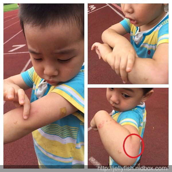 NATURKEY力萃奇防蚊液