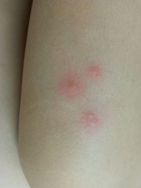 NATURKEY力萃奇防蚊液