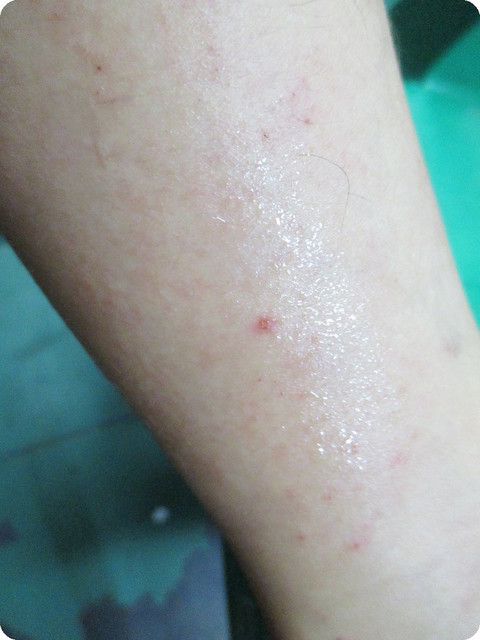 NATURKEY力萃奇防蚊液