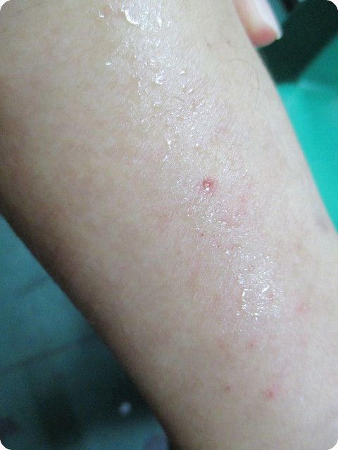 NATURKEY力萃奇防蚊液