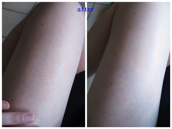 NATURKEY力萃奇防蚊液