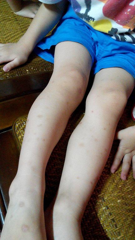 NATURKEY力萃奇防蚊液