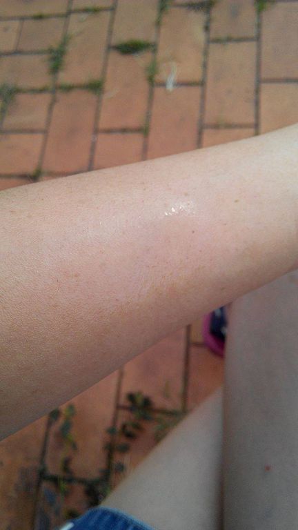 NATURKEY力萃奇防蚊液