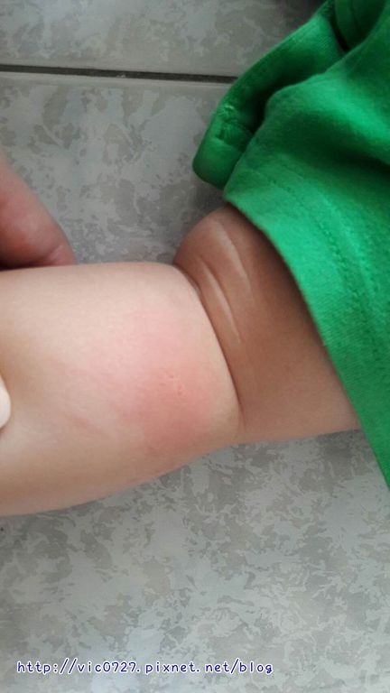 NATURKEY力萃奇防蚊液