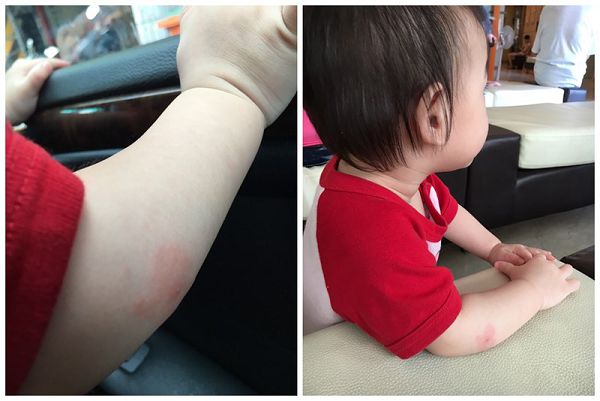 NATURKEY力萃奇防蚊液