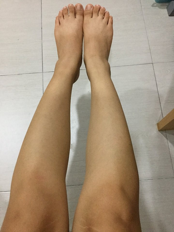 NATURKEY力萃奇防蚊液