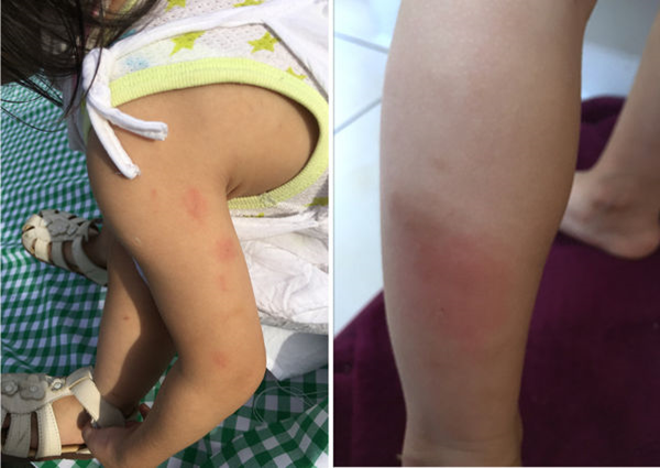 NATURKEY力萃奇防蚊液