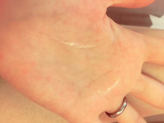 NATURKEY力萃奇防蚊液