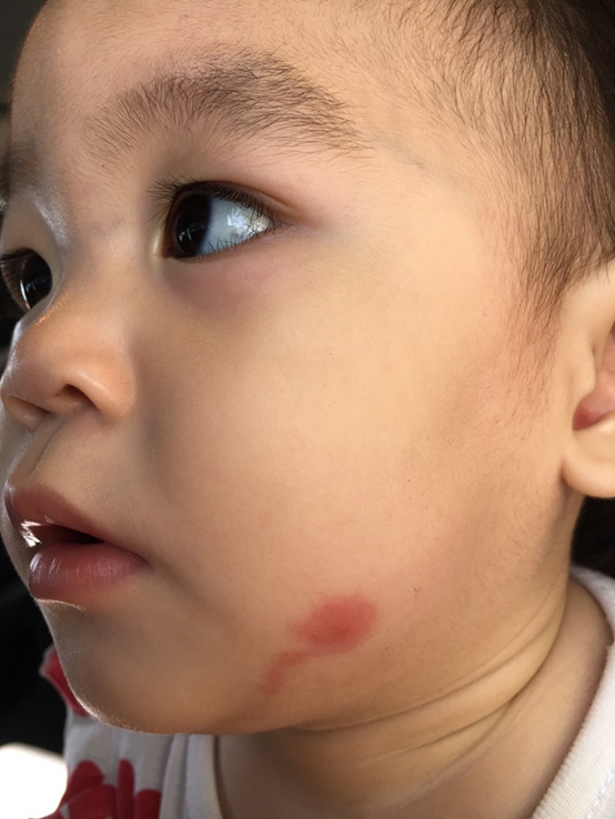 NATURKEY力萃奇防蚊液