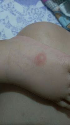 NATURKEY力萃奇防蚊液