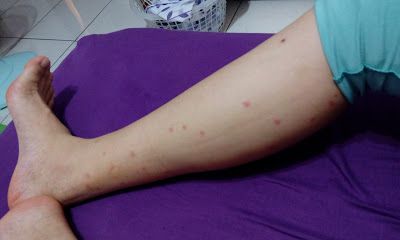 NATURKEY力萃奇防蚊液