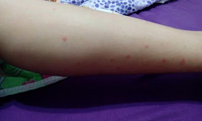 NATURKEY力萃奇防蚊液