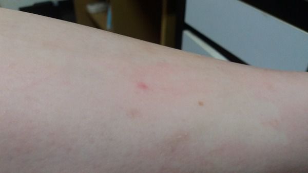 NATURKEY力萃奇防蚊液