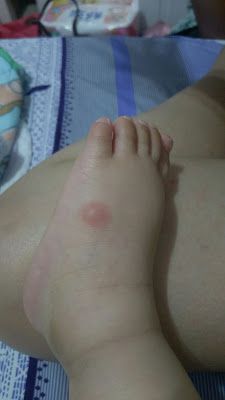 NATURKEY力萃奇防蚊液