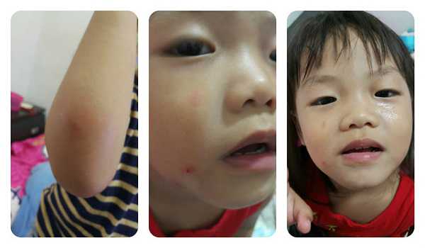 NATURKEY力萃奇旺福金安膏