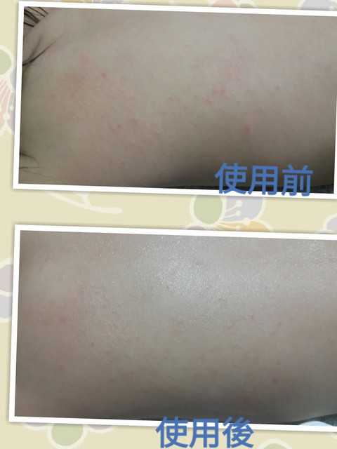 NATURKEY力萃奇旺福金安膏