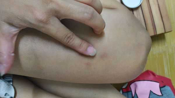 NATURKEY力萃奇旺福金安膏