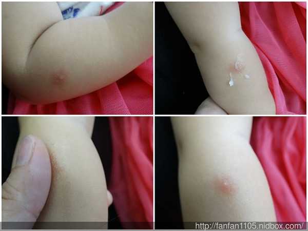 NATURKEY力萃奇旺福金安膏