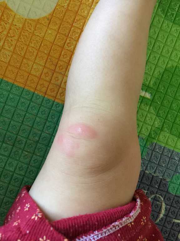 NATURKEY力萃奇旺福金安膏