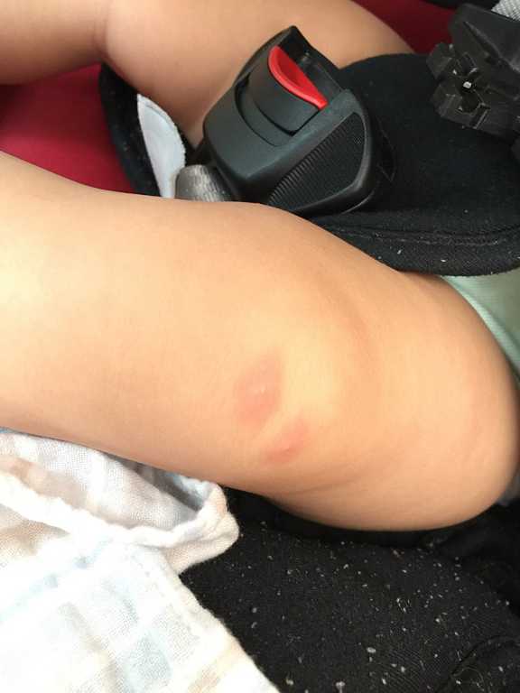 NATURKEY力萃奇旺福金安膏