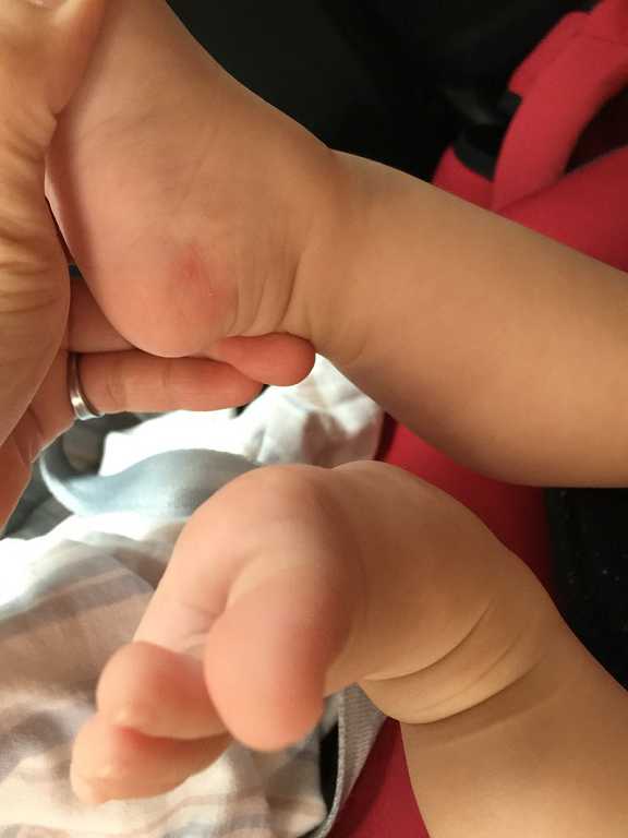 NATURKEY力萃奇旺福金安膏