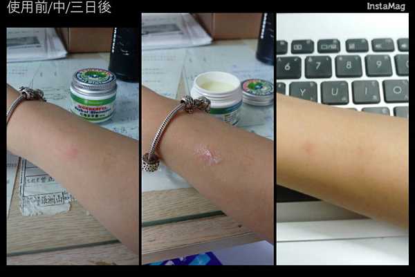 NATURKEY力萃奇旺福金安膏