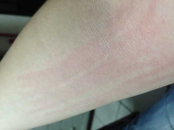 NATURKEY力萃奇旺福金安膏