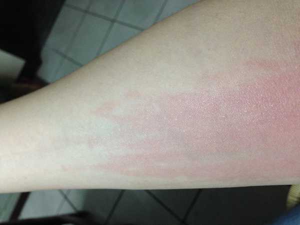 NATURKEY力萃奇旺福金安膏