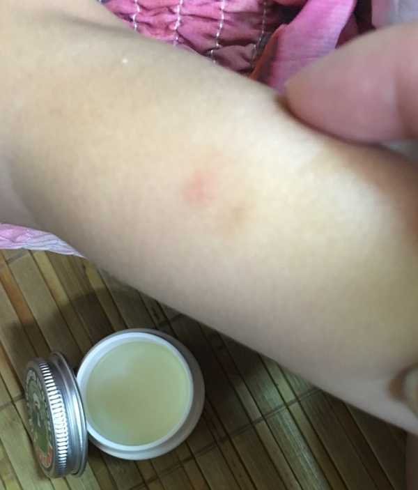 NATURKEY力萃奇旺福金安膏