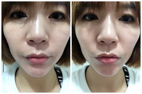 NATURKEY力萃奇旺福金安膏